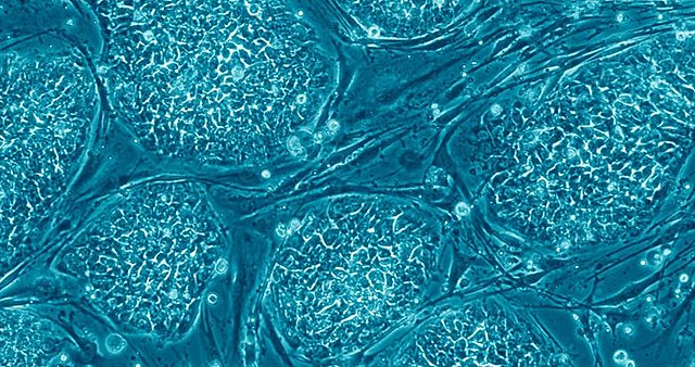 Stem cells were discovered.