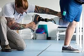 development of the first advanced-movement prosthetic leg