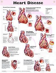 Heart Disease Deaths Drop by 40 Percent