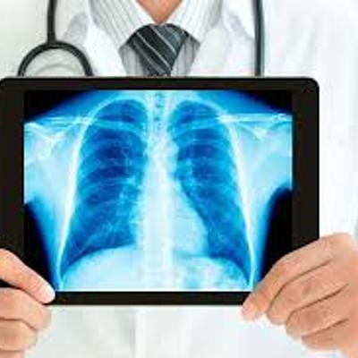 Timeline: Evolución de la protección radiológica