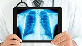 Timeline: Evolución de la protección radiológica