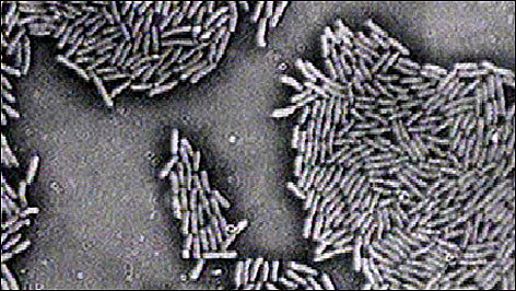 Robert Koch discovered the bacteria that causes Tuberculosis