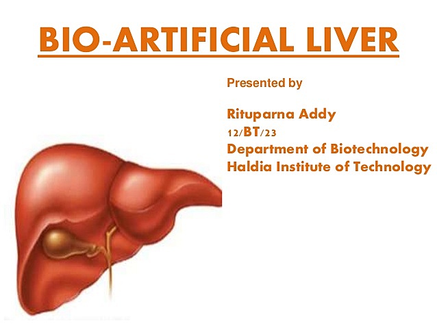 Artificial liver