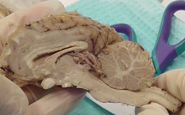 Sheep Brain Disection