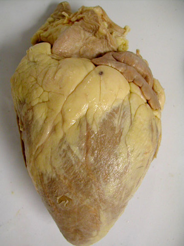 Heart Disection