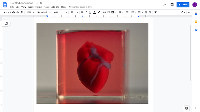 3D print heart from human patient cells