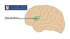 Área Broca