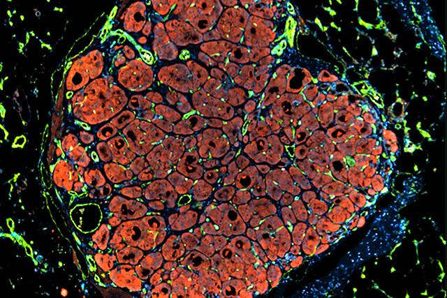Liver grown by stem cells