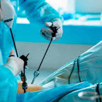 Timeline: HISTORIA DE LA LAPAROSCOPIA