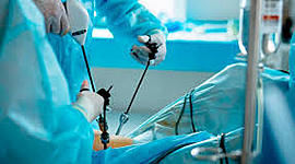 Timeline: HISTORIA DE LA LAPAROSCOPIA