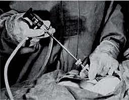 PROCEDIMIENTOS POR UNA INCISION