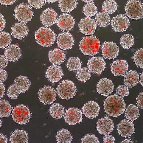 Smallpox is erradicated