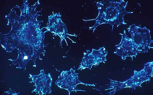 Proterosoikum - Esimesed mitmerakulised organismid