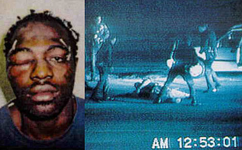 Agresión a Rodney King