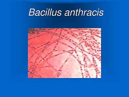 Descubrimiento del virus BACILLUS ANTHRACIS "Ántrax"
