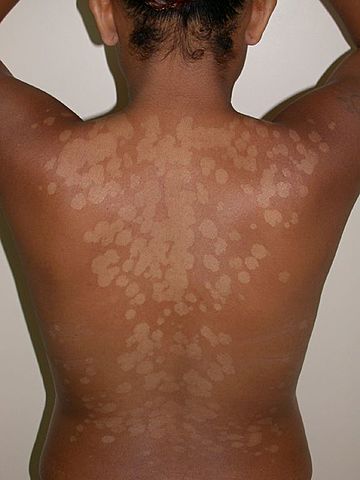 Karl Ferdinand Eichstedt (1816-1892)