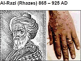 Rhazes