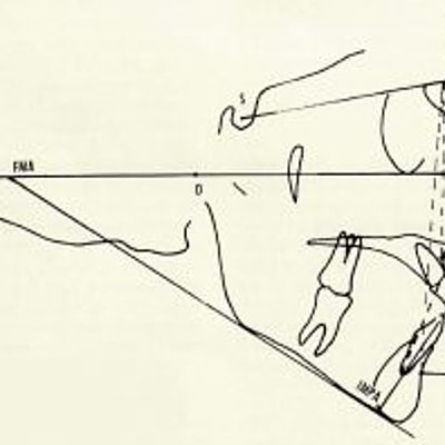Timeline: HISTORIA DE LA ORTODONCIA
