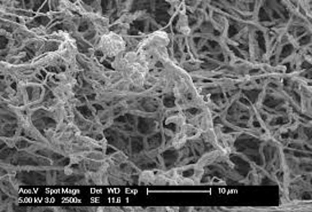 Genoma del Saccharopolyspora erythraea