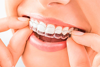 ÉPOCA ACTUAL   DÉCADA DE LO 70´S