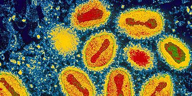 Inicio de campaña para eliminar la viruela