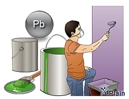 El  Plomo,  Intoxicacion Laboral