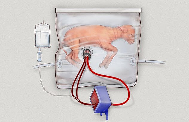 The Artificial Womb