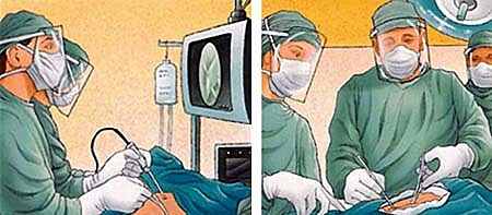 em van operar per primera vegada!