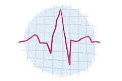 Electrocardiograph