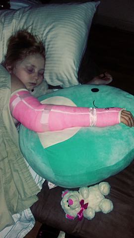 ava broke her arm