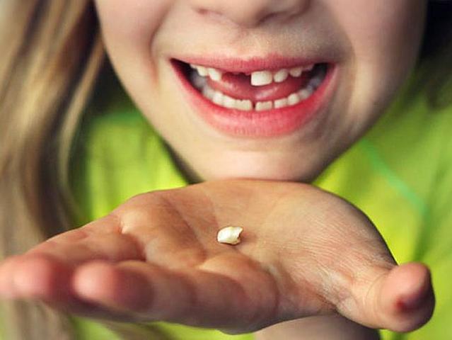 sem cau la primera dent