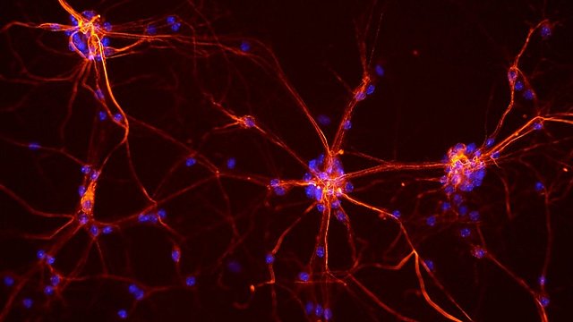 Llamada de aprendizaje Hebb