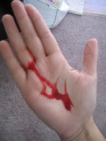 When I had a cut in my hand