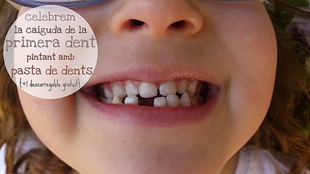 Em cau la primera dent