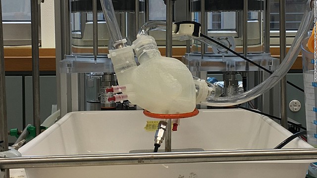 3D printed heart from human patient cells