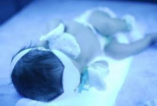 The first discription on light therapy in jaundice infants