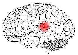 Neuropsicología del lenguaje