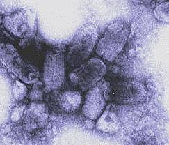 Descubrimiento de Agentes Etiològicos"