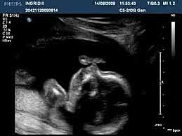 4 month Pregnancy BABY