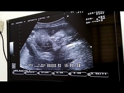 7 month pregnancy BABY