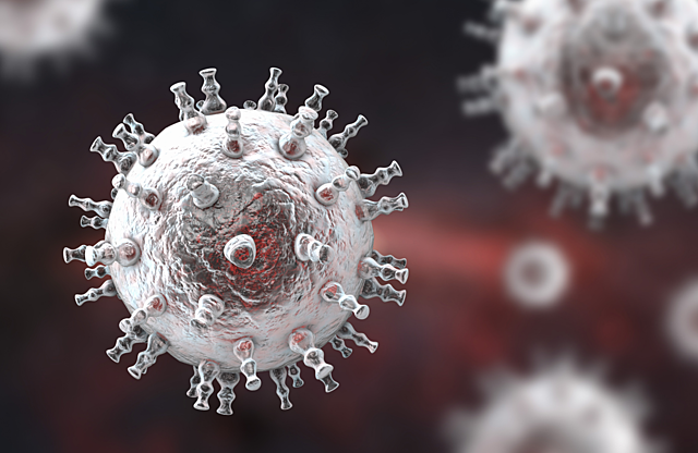 One of the First Cases of Kaposi Sarcoma