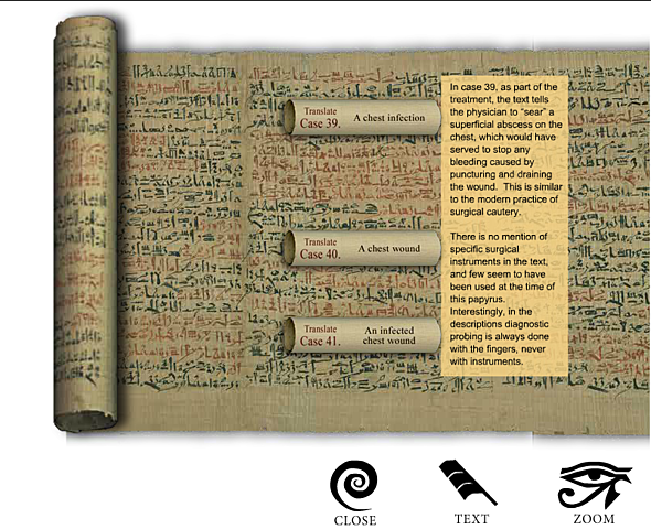 El Papiro Quirúrgico de Edwin Smith