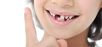 Se'm cau primera dent