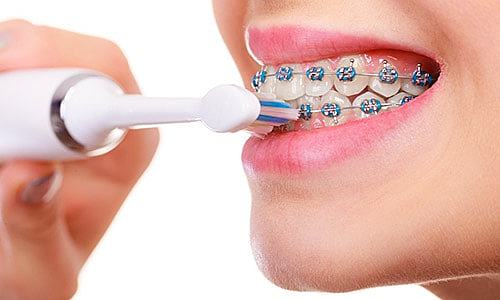 primer cop que em posen aparatos