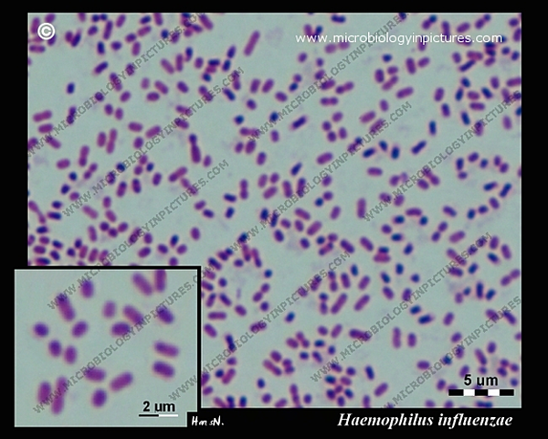 "Haemophilus influenzae"