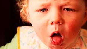 Whooping cough