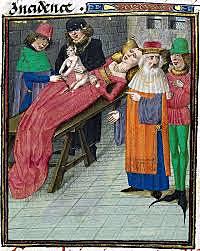 First Cesarean Section