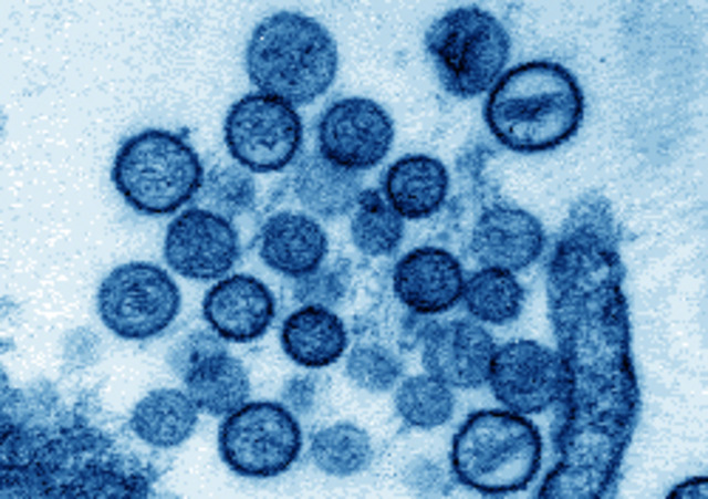 A human disease is first attributed to genetic causes