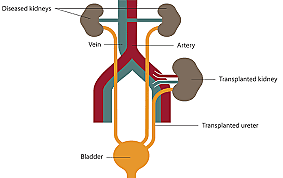 Dr. Joseph E. Murray performs the first kidney transplant between identical twins.