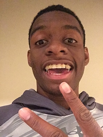 Yo fui a un ortodoncista oficina para poner frenillos.